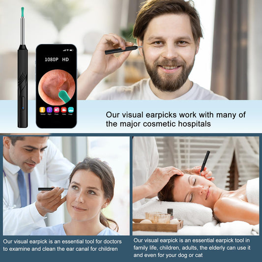 Ear Wax Removal Tool Berlaney, Ear Cleaner with1080P HD Otoscope Camera, Ear Camera Otoscope with Light, 6 LED Lights, Built-in WiFi,Ear Cleaning Kit for iPhone and Android Phones